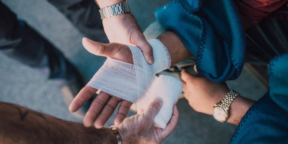Injured hands